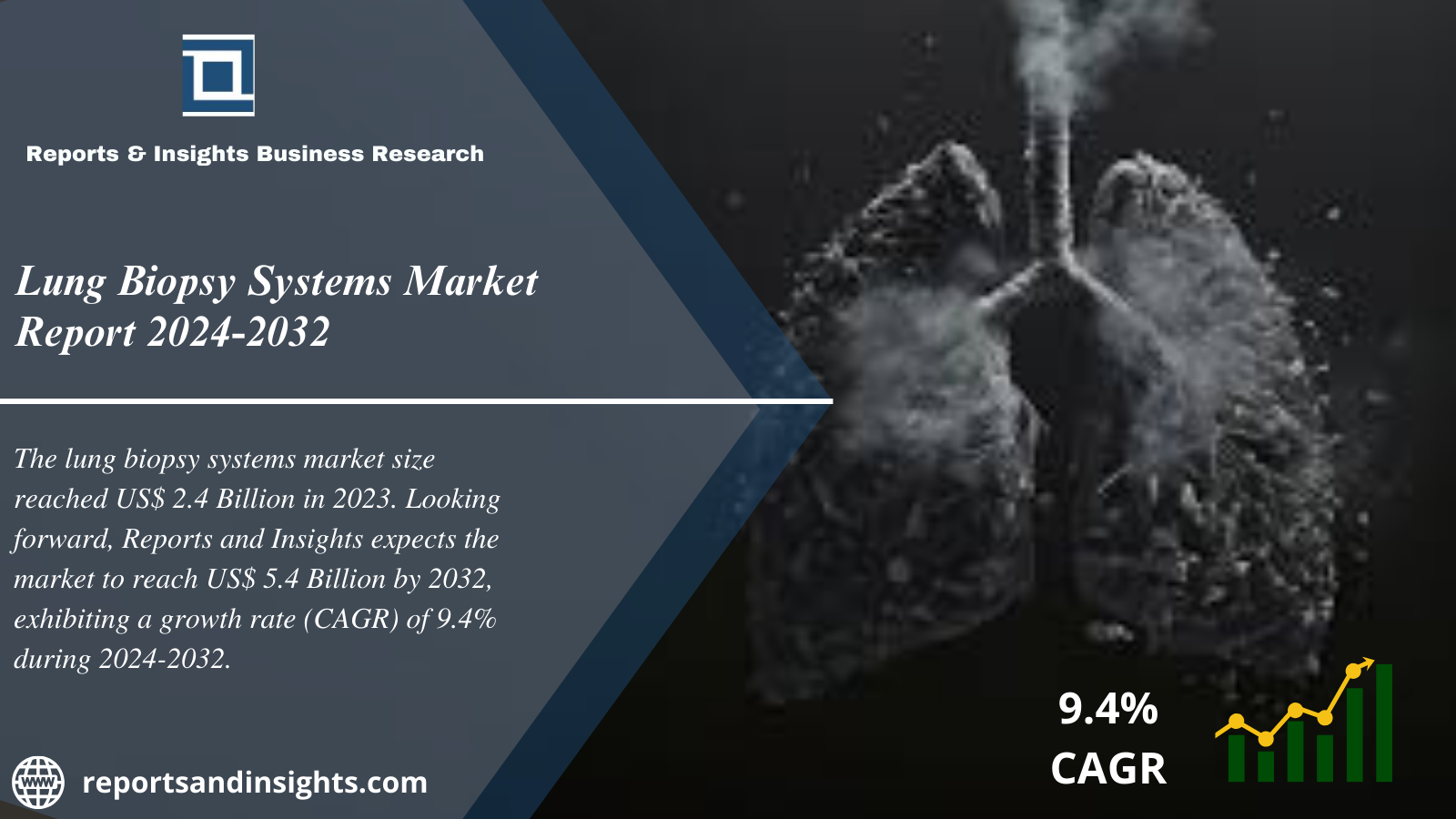 Lung Biopsy Systems Market Report 2024 to 2032: Industry Analysis, Growth, Share, Trends, Size and Forecast